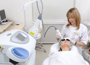 prednosti in slabosti delnega pomlajevanja kože obraza z laserjem
