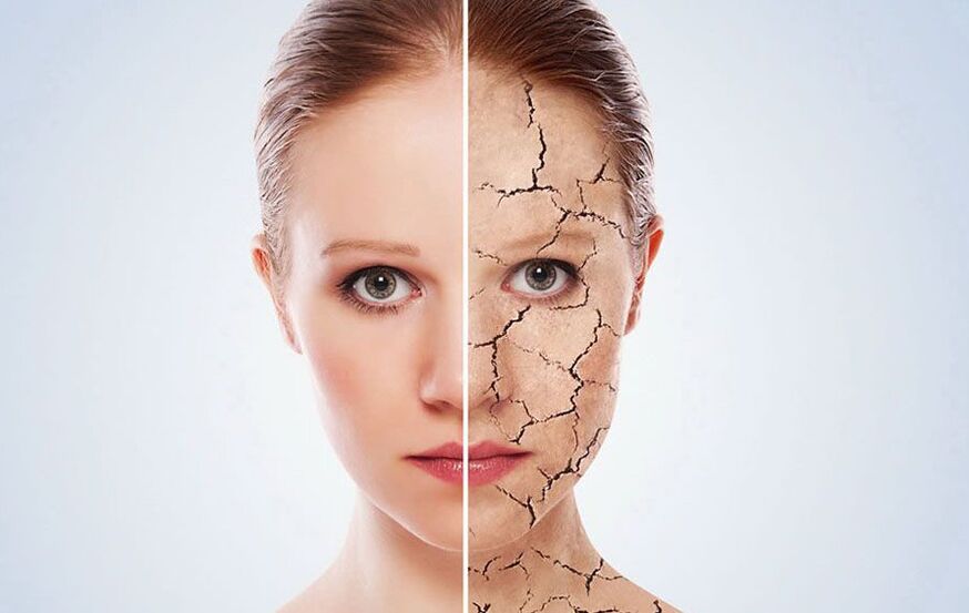 kako ohraniti kožo obraza mladostno