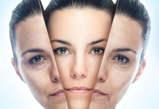 Postopek odstranjevanja kože obraza pred starostnimi spremembami